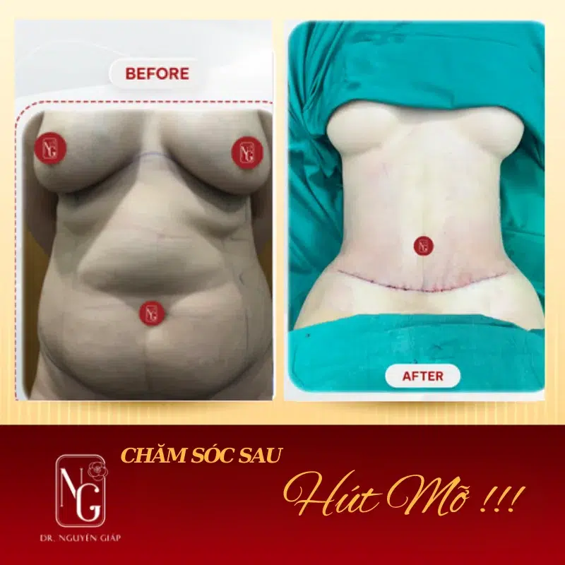 cai thien suc khoe va tu tin