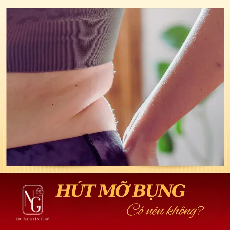 co nen hut mo bung khong