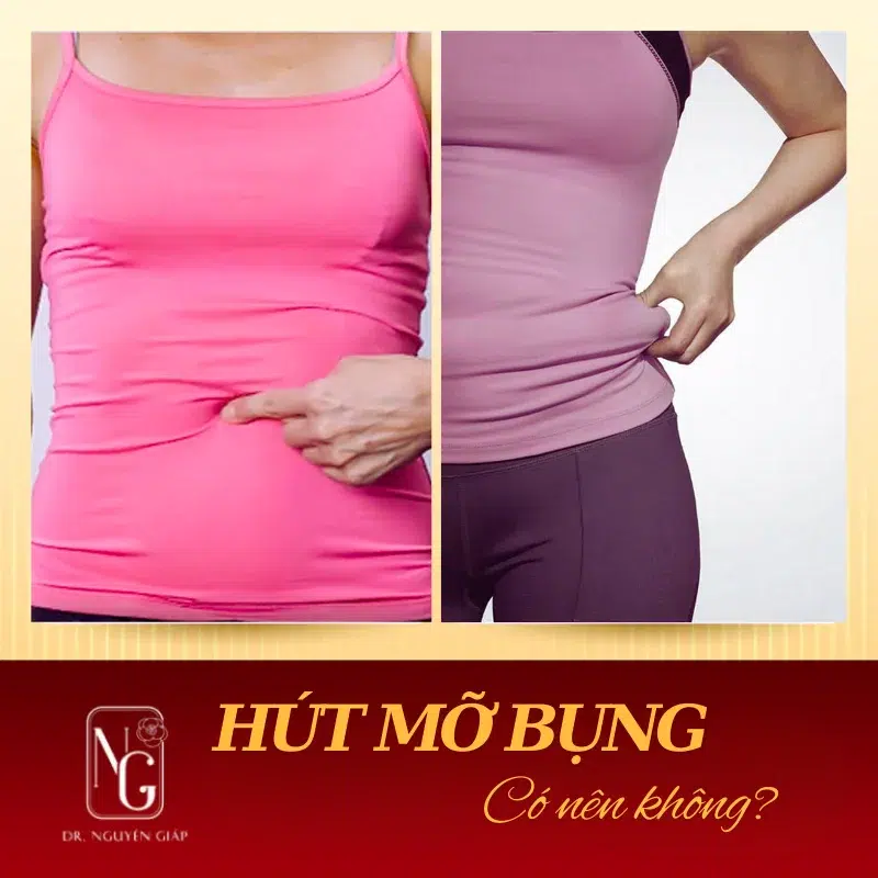 hut mo bung giup loai bo di mo thua nhanh chong