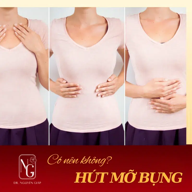 hut mo bung phau thuat co hieu qua nhanh chong