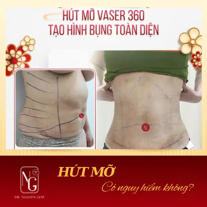 hut mo co nguy hiem khong