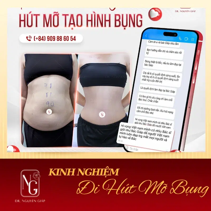 kinh nghiem di hut mo phai biet