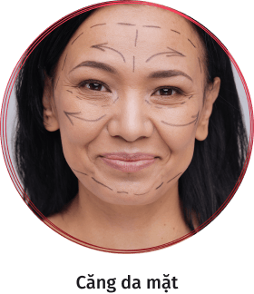 cắt da mặt