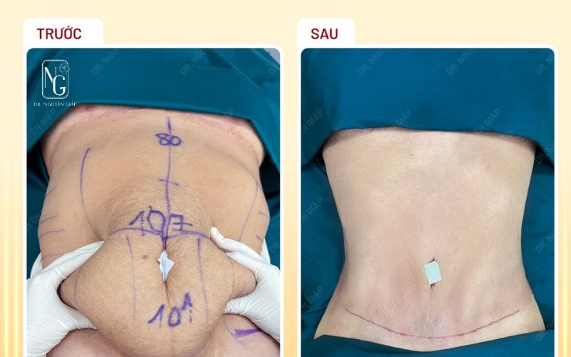 Giới thiệu dịch vụ