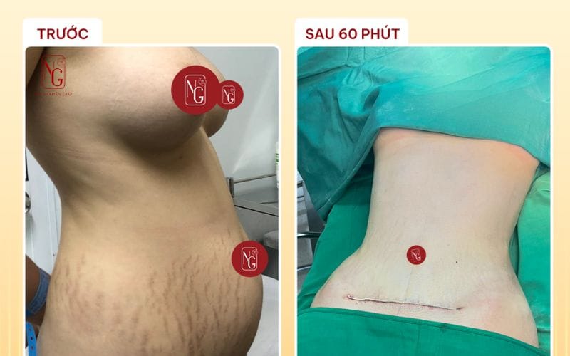 Kết quả thực tế mang lại