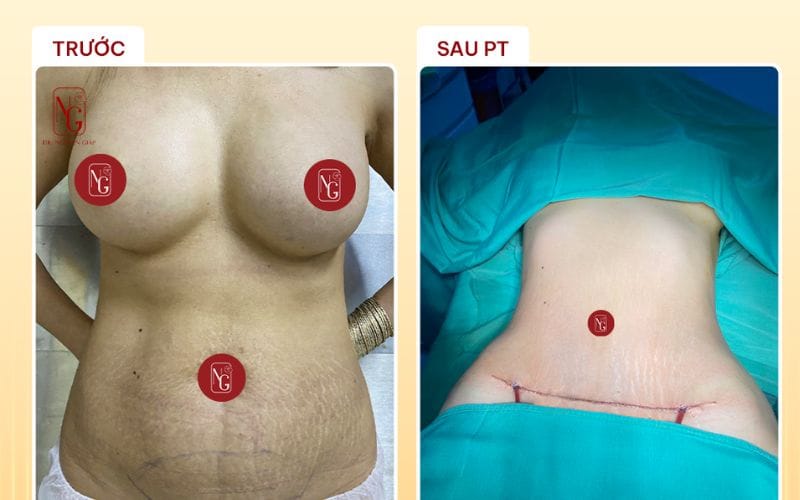 Kết quả thực tế mang lại