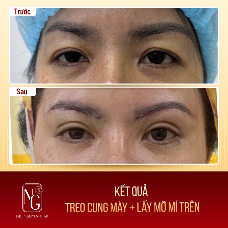 Giới thiệu dịch vụ