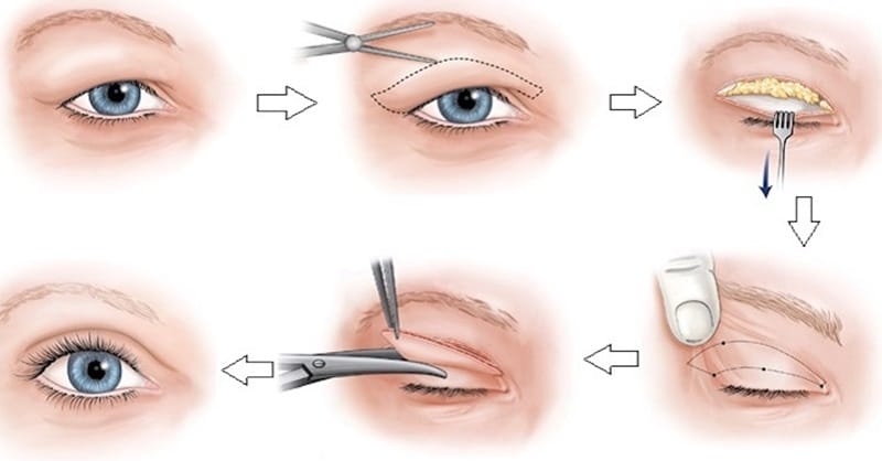Các câu hỏi thường gặp