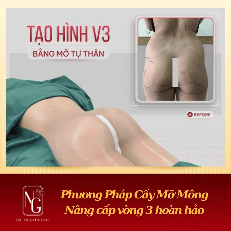 cay mo mong tao hinh vong 3 hoan hao