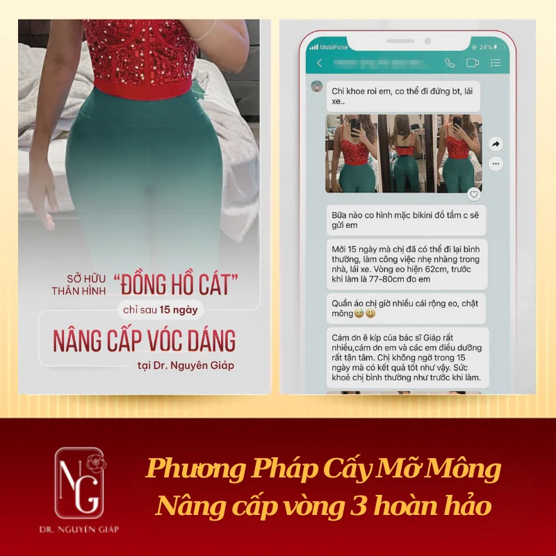feedback khach hang nang mong tai dr nguyen giap