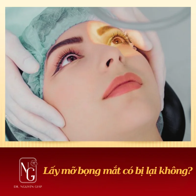 lay mo bong mat co bi lai khong