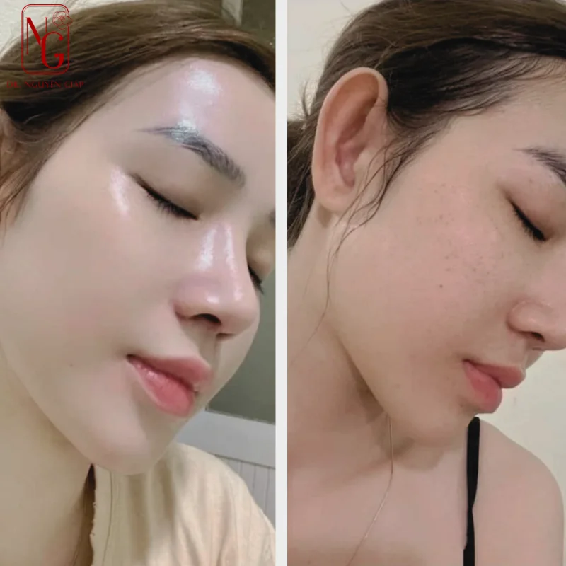 phuong phap cay mo tu than la gi