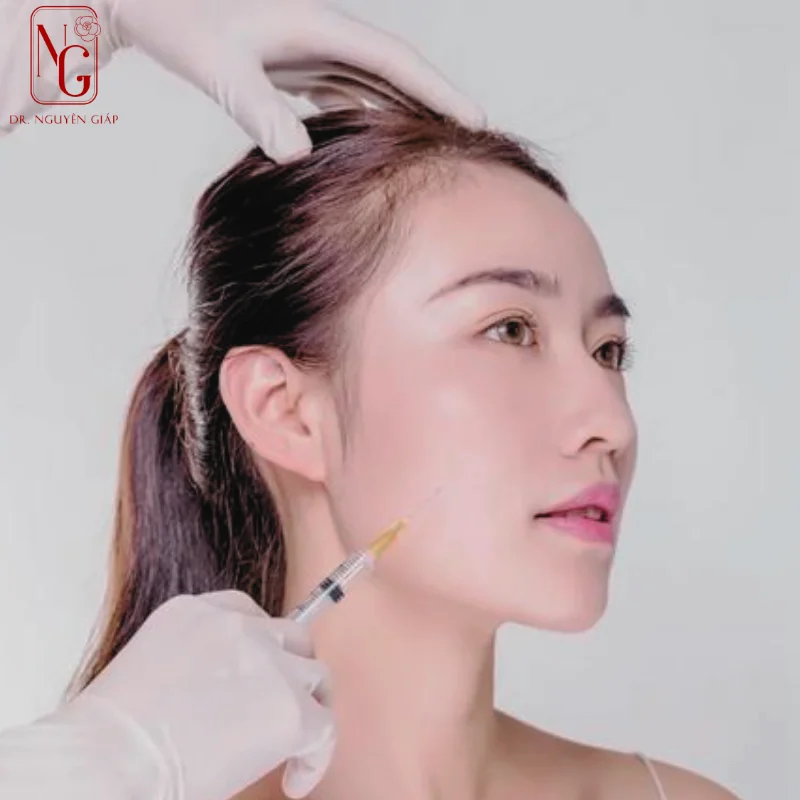 Nên Cấy Mỡ Tự Thân Hay Tiêm Filler