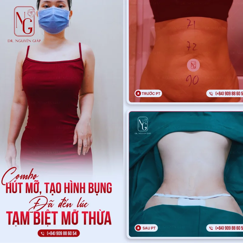 cham soc hau phau de giam phu ne sau hut mo