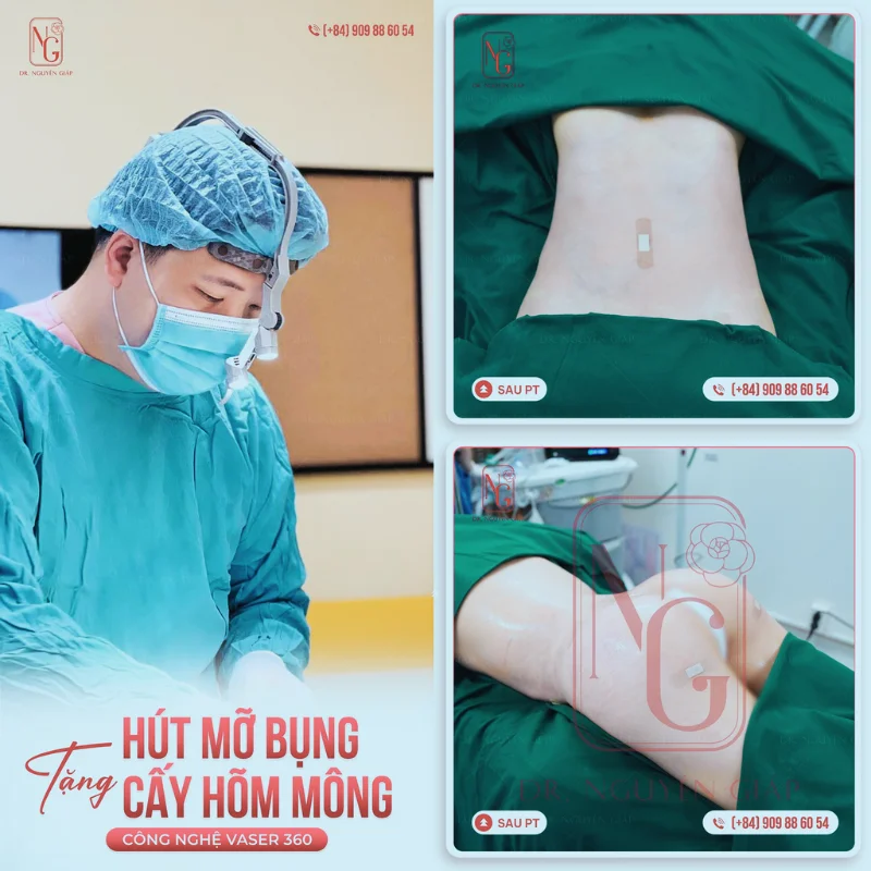 giai phap hut mo cho me bim sau sinh