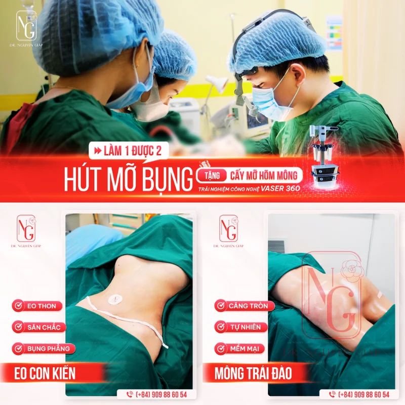 hinh anh thuc hien phau thuat hut mo bung sau sinh