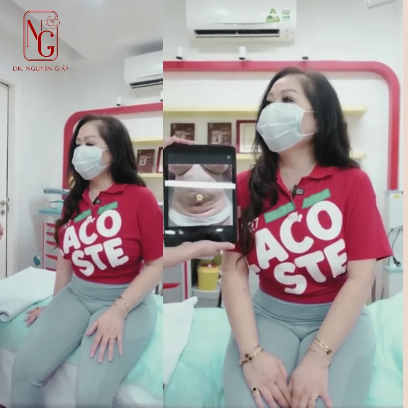 hut mo bung lipo ultrasound cho khach hang