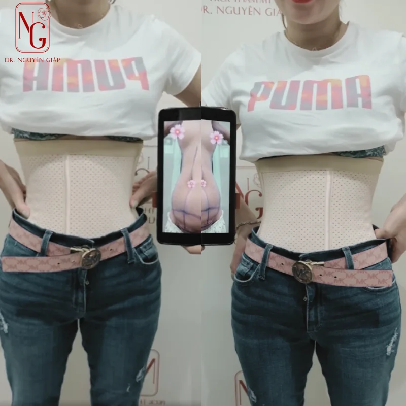 hut mo bung phai nit bung bao lau