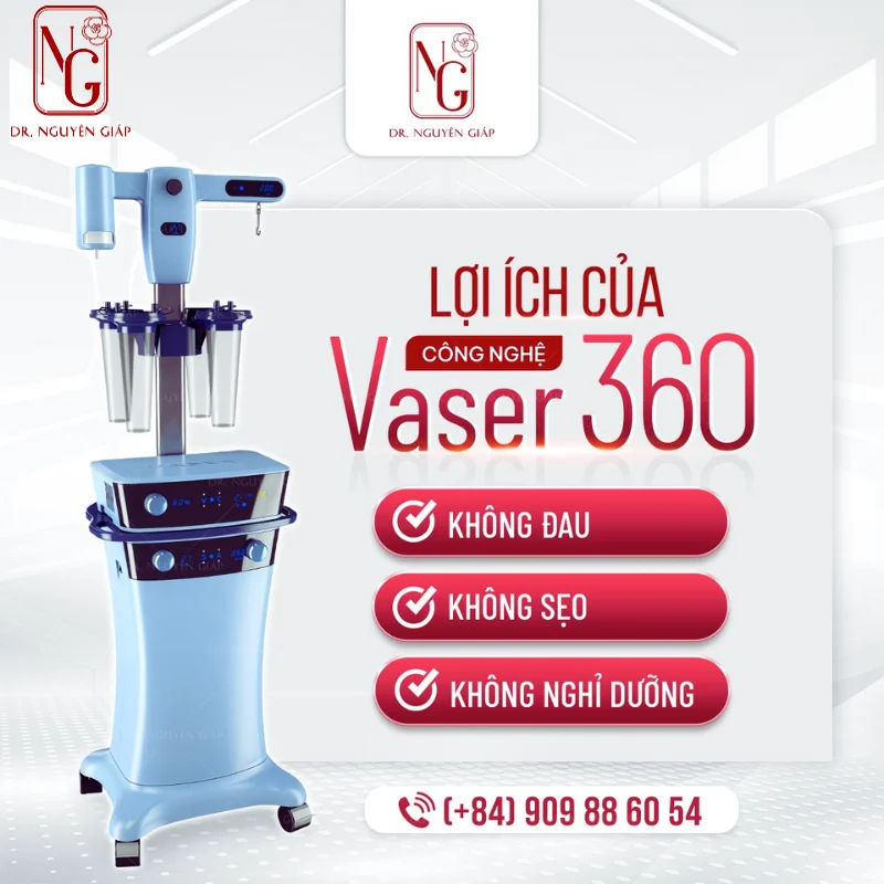 su dung cong nghe hut mo vaser 360