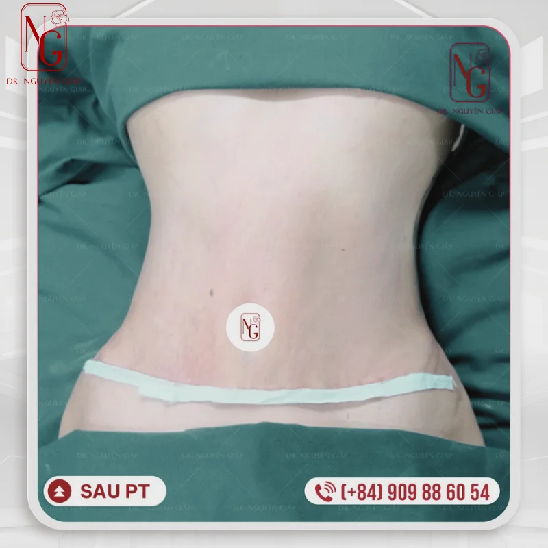 ton dang voi vong eo 70cm