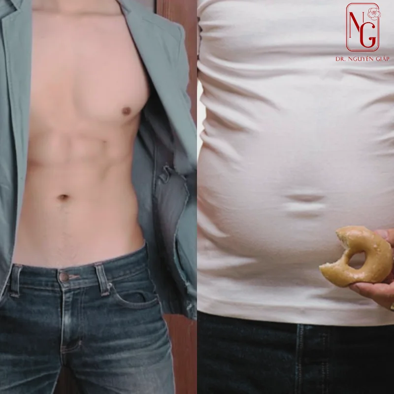 truoc va sau khi hut mo bung tao hinh 6 mui