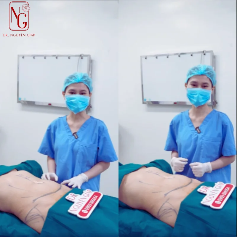 tu van truoc khi phau thuat tai dr nguyen giap