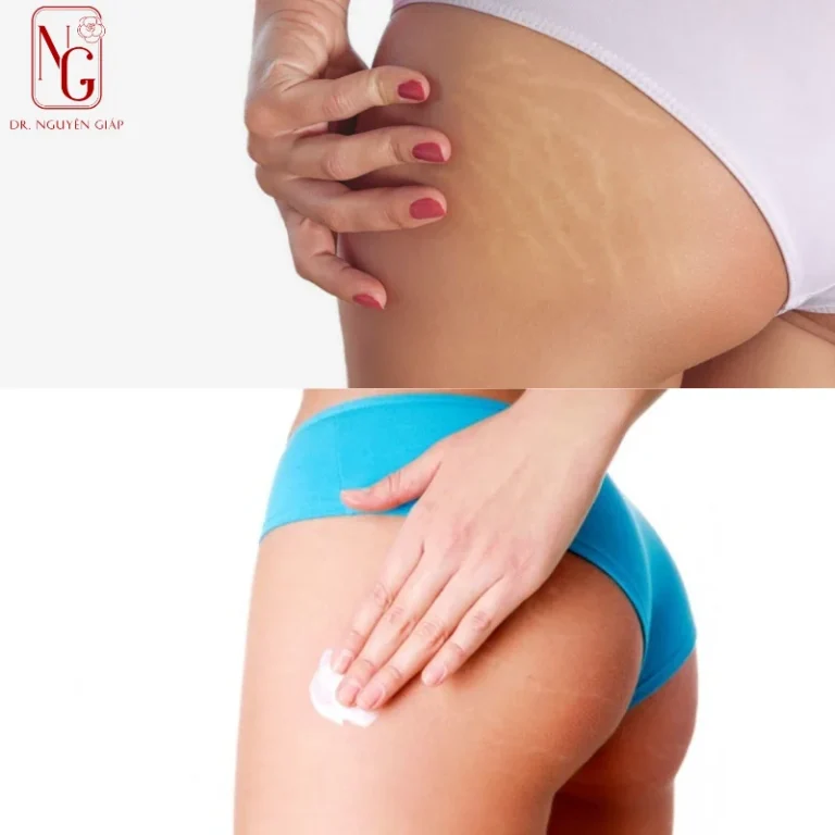 tay te bao chet giup giam tham mong