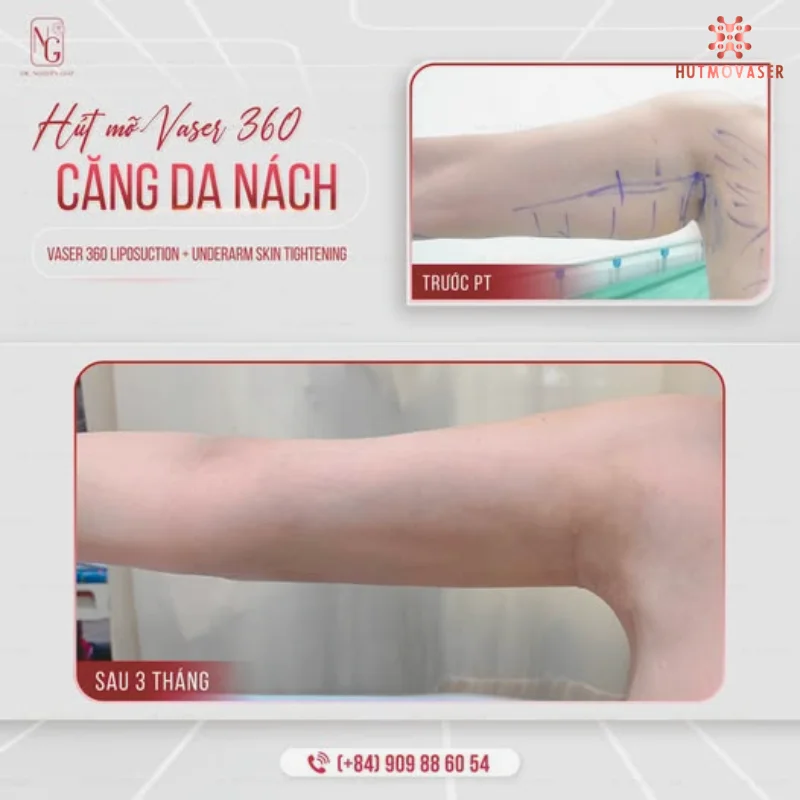 cong nghe cang da nach tien tien