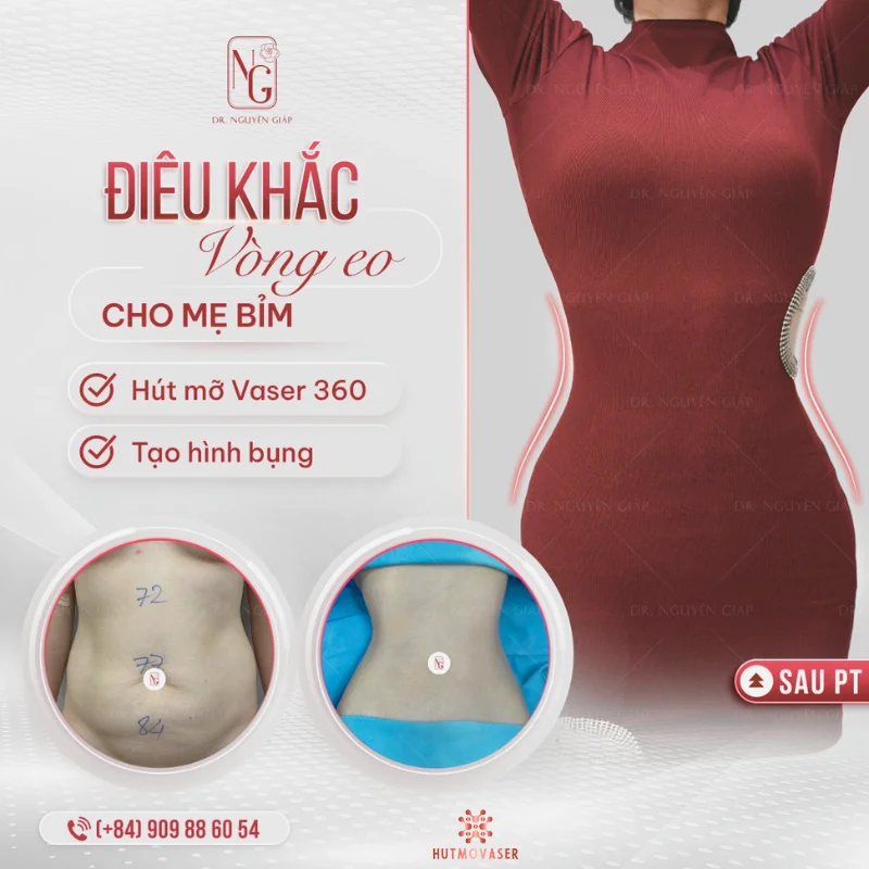 tao hinh dang bung dep