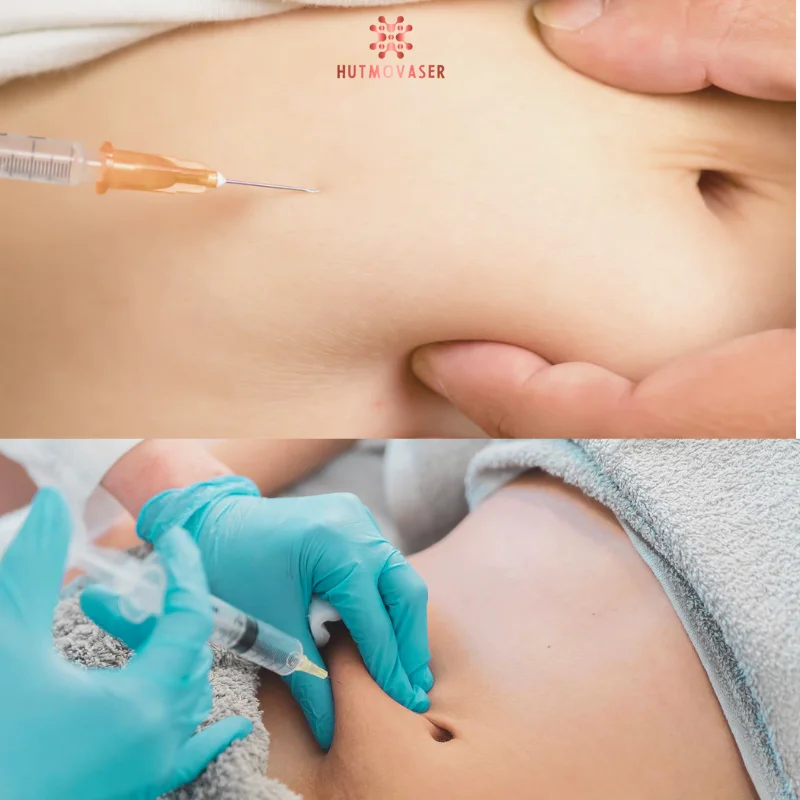 tiem tan mo co tot khong