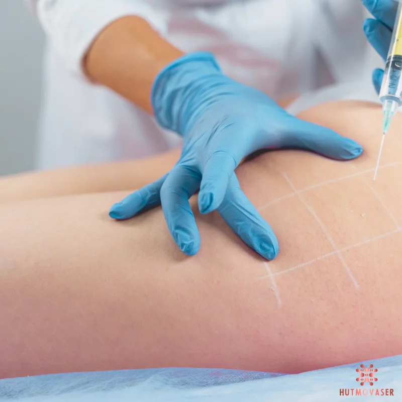 tiem tan mo vung mong dui